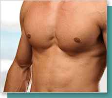 MALE-BREAST-REDUCTION-GYNECOMASTIA